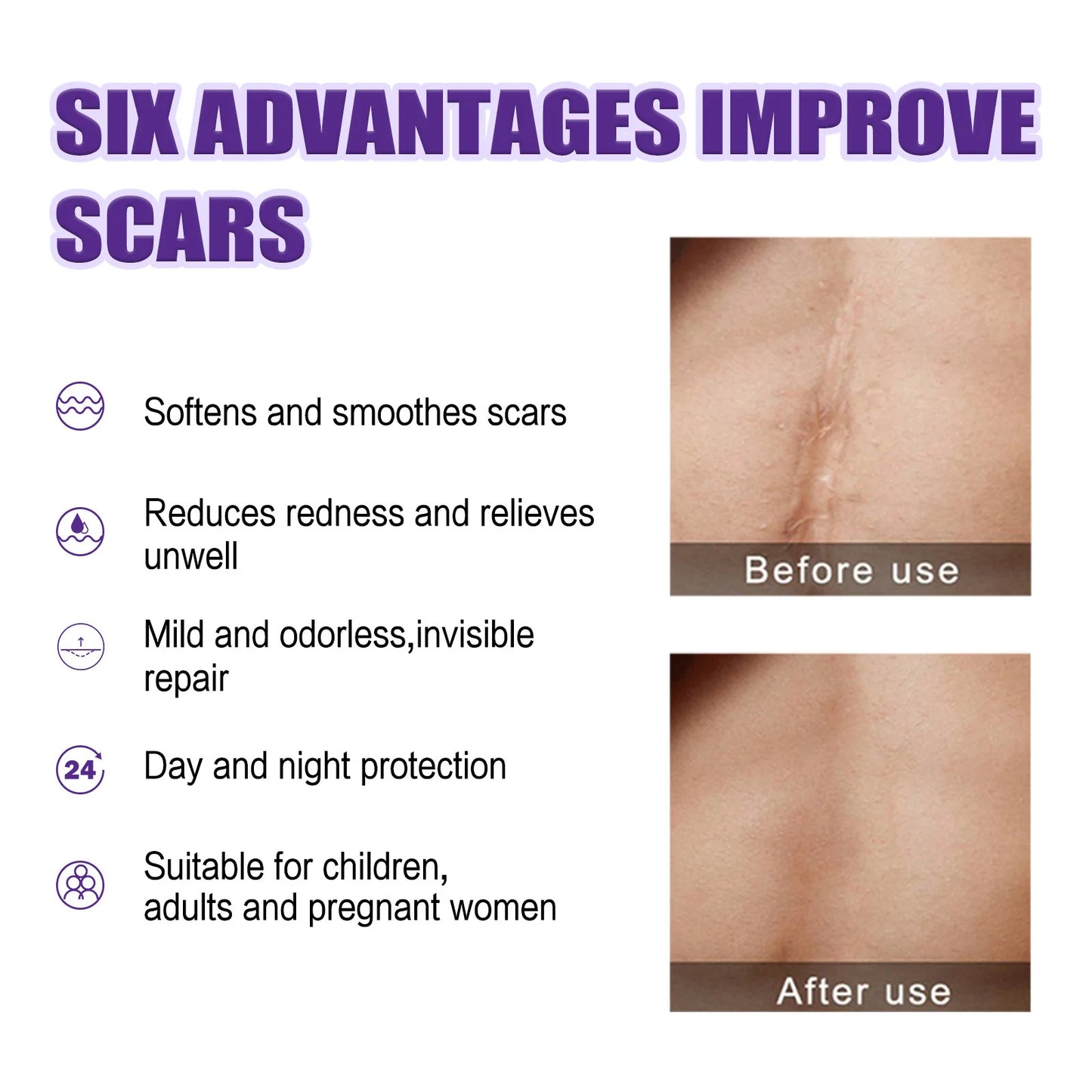 Recovery Scar Cream Fast Remove Deep Skin Scar Acne Stretch Marks Burn Keloid Spot Treat Gel Herbal Smooth Whiten Face Skin Care