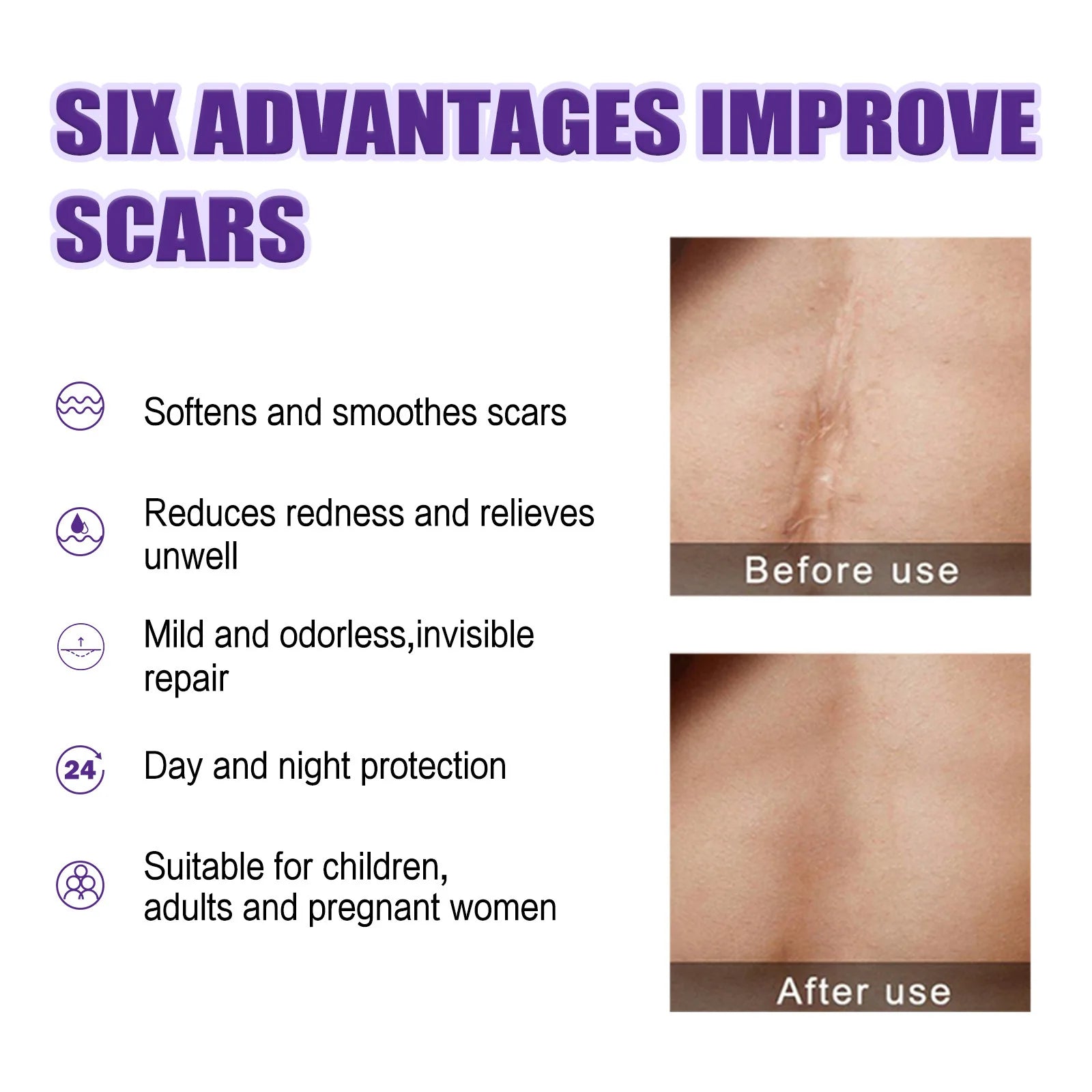 Recovery Scar Cream Fast Remove Deep Skin Scar Acne Stretch Marks Burn Keloid Spot Treat Gel Herbal Smooth Whiten Face Skin Care