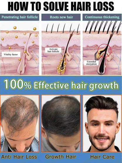 【Hot Selling】Miracle Hair Growth Essence, Awakening Hair Follicle Vitality