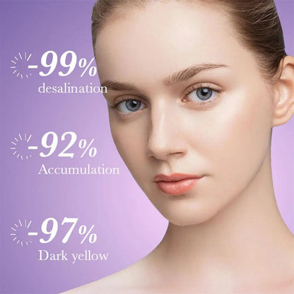 3pcs Nicotinamide Whitening Freckles Cream Remove Melasma Dark Spot Acne Marks Brightening Skin Tone Face Skin Care