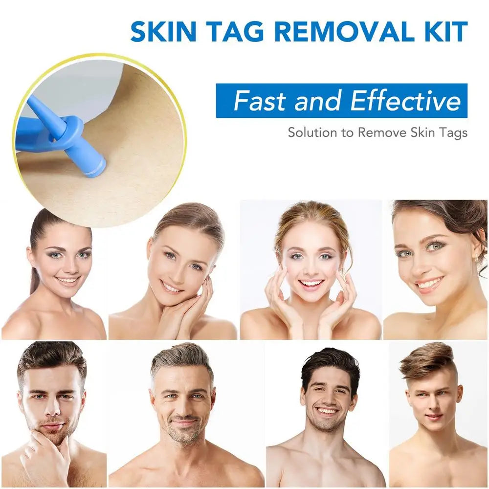 Tags Skin Remover Kit Dual-head Skin Tags Bands Remover Kit Safe Skin Tags Repair Tool With 40 Rubber Bands To Remove 2-7mm