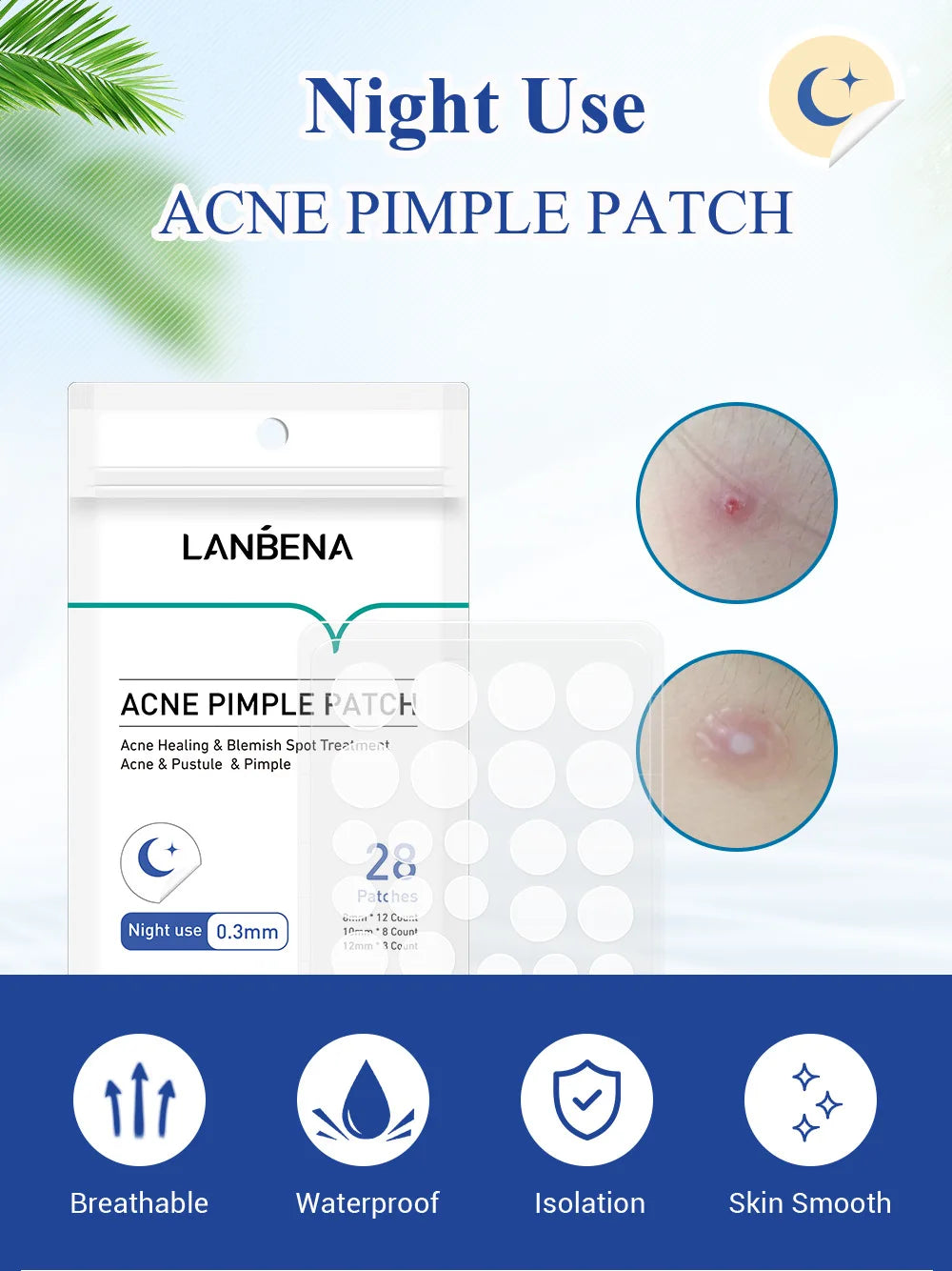 LANBENA Invisible Acne Pimple Patch Face Mask Acne Pimple Blemish Removal Stickers Acne Treatment Master Daily / Night Use