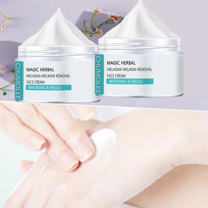 Effective Whitening Cream Remove Melasma Acne Spot Pigment Dark Spot Pigmentation Skincare