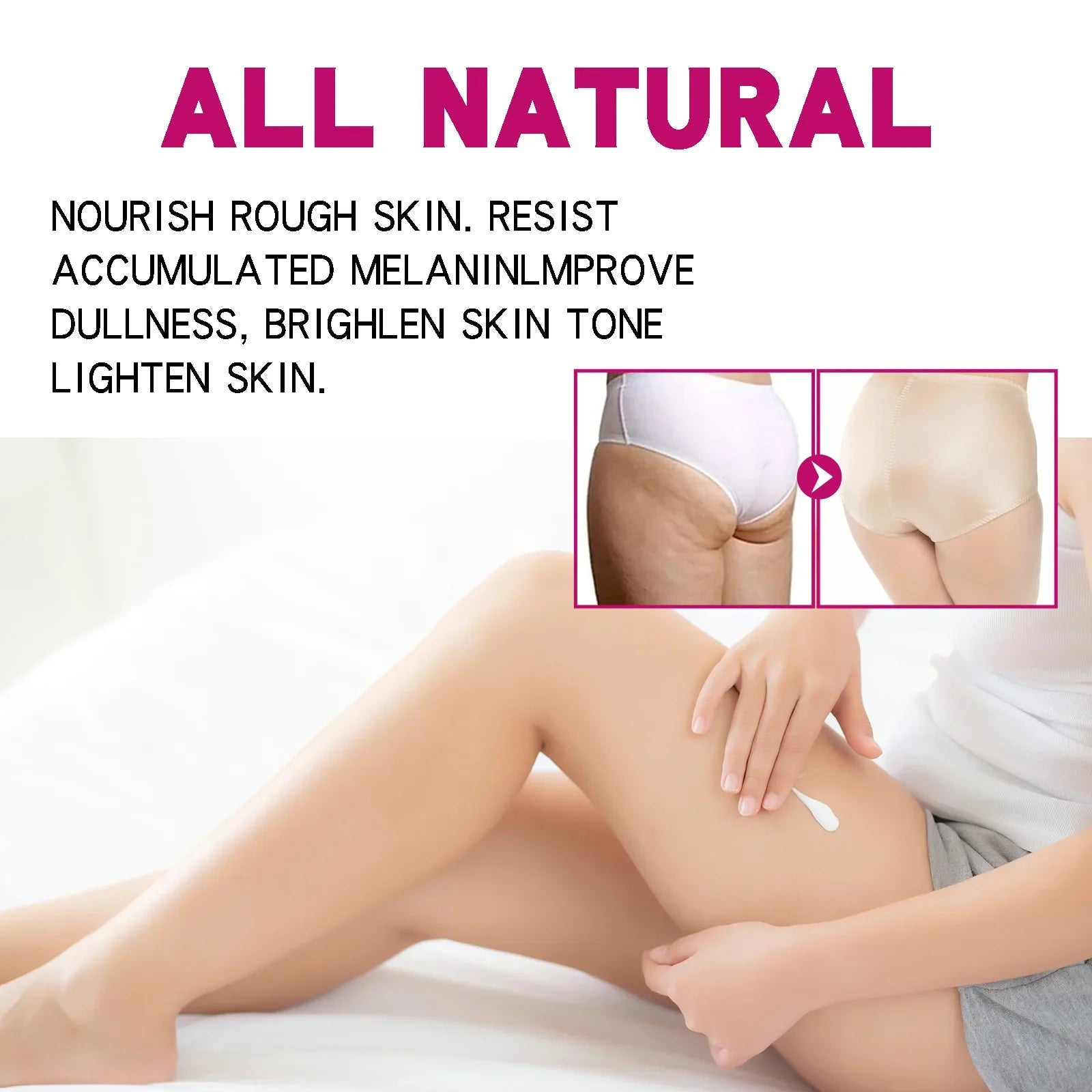 Inner Thigh Whitening Cream Butt Acne Treatment Serum Buttock Clearing Pimples Smooth Skin Care Fade Dark Spots Brighten Lotion