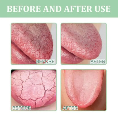 Fissured Tongue Relief Spray Breath Freshener Spray Regulates Health Mint Natural Flavor Care Oral Essence Mouth Health