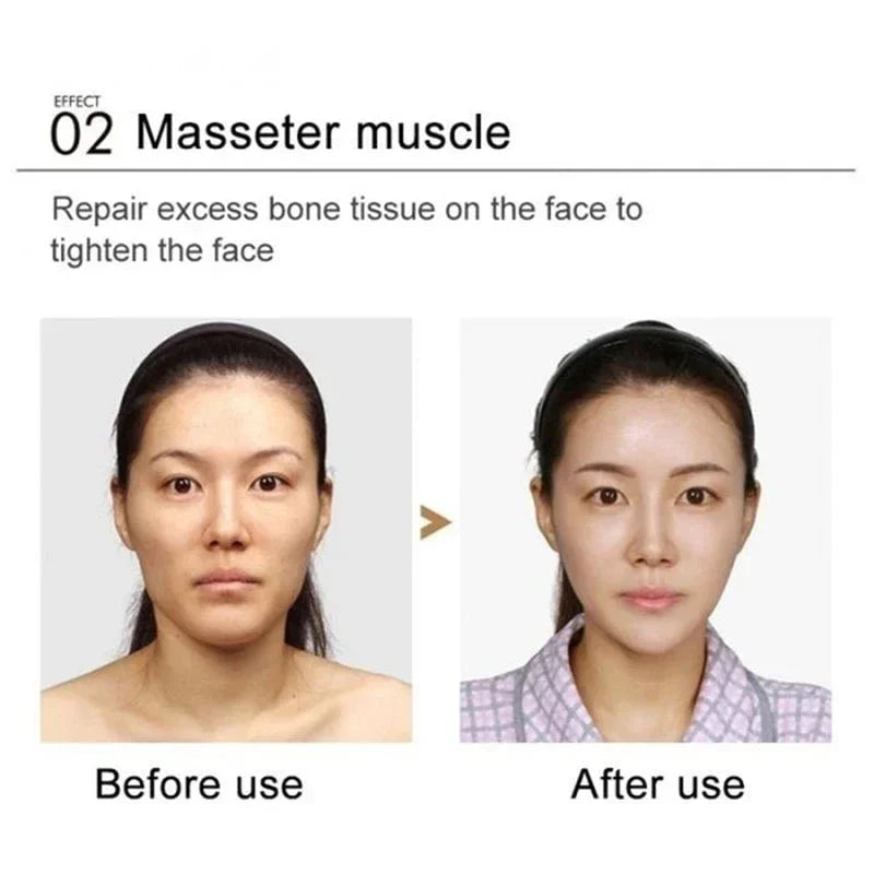 Hot V-Shape Slimming Cream Removal Double Chin Firming Tighten Mandibular line Slimming Masseter Face Muscle Fat Burning Cream