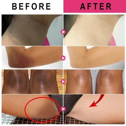 Whitening Cream Quickly Private Parts Dark Skin Underarm Brightening Cream Inner Thighs Elbows Bleach Joint Remove Melanin Cream