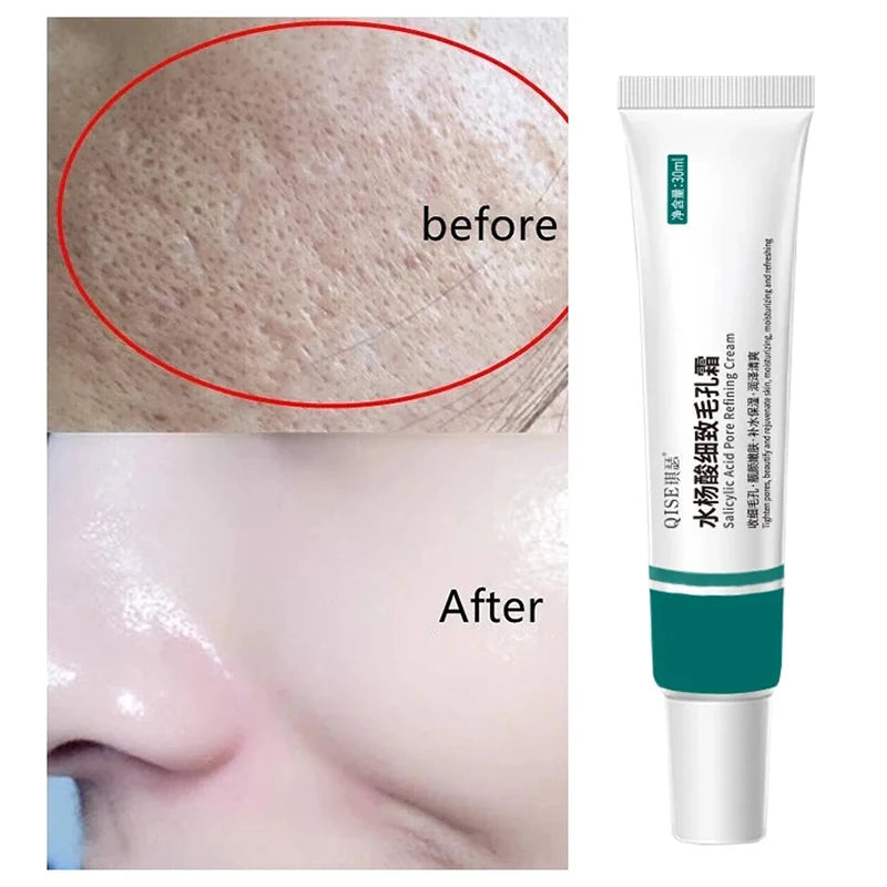 Salicylic Acid Pore Shrinking Cream Quick Remove Blackehead Elimination Large Pores Tighten Face Smooth Skin Care Products New