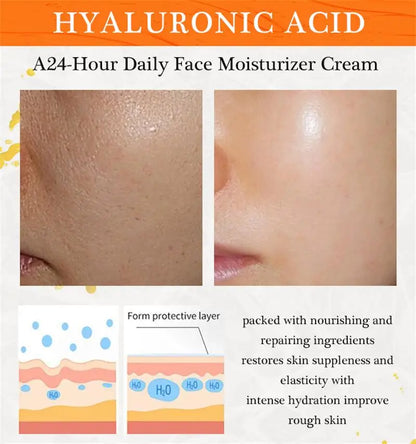 Powerful Whiten Freckle Cream Fast Remove Melasma Melanin Correcter Anti-Pigmentation Dark Spot Fade Improve Dullness Skin Care