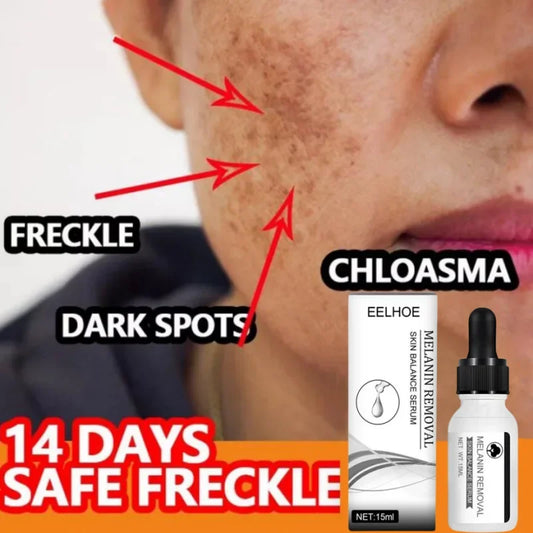 Niacinamide Dark Spot Remove Serum Anti-aging Bright Freckle Whiten Skin Cream Fade Pigmentation Melasma Moisture Face Skin Care