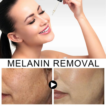 Niacinamide Dark Spot Remove Serum Anti-aging Bright Freckle Whiten Skin Cream Fade Pigmentation Melasma Moisture Face Skin Care