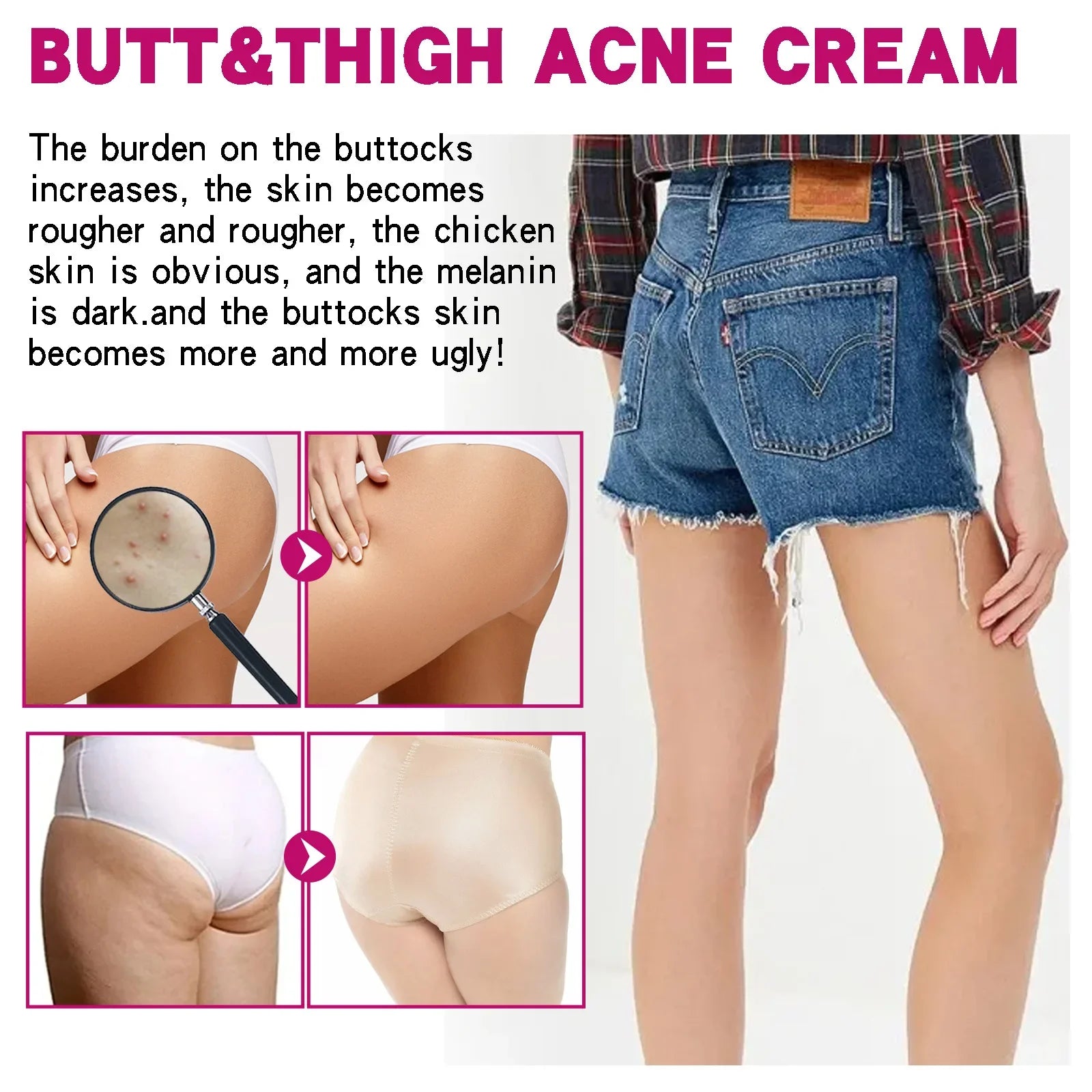 Inner Thigh Whitening Cream Butt Acne Treatment Serum Buttock Clearing Pimples Smooth Skin Care Fade Dark Spots Brighten Lotion