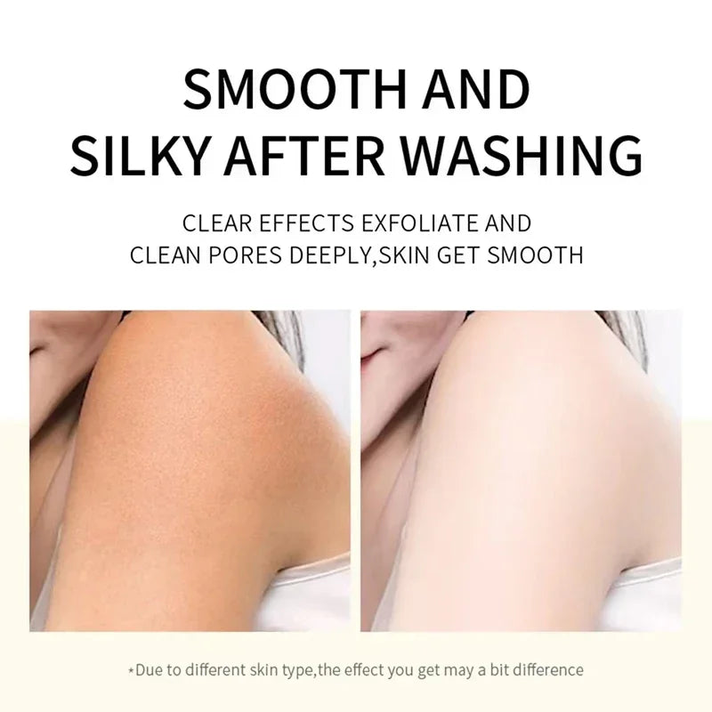 Chicken Skin Removal Treatment Body Scrub Cream Remove Dead Skin Cell Pore Spot Dull Whitening Moisturizing Body Care Cream