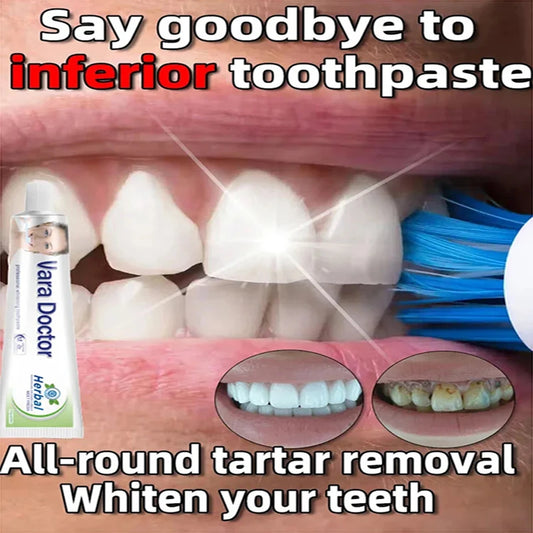 Remover Dental Calculus Remove Yellow Teeth Mouth Odor Removal Bad Breath Preventing Periodontitis Cleansing Care Toothpaste