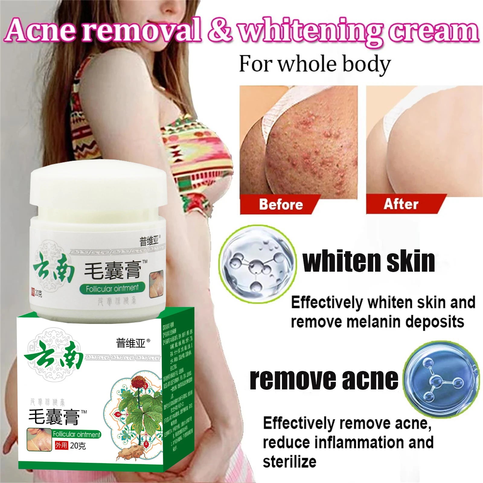 Body Acne Removal Cream Treatment Face Butt Back Acne Marks Smooth Repair Chicken Skin Cream Moisturizing Whitening Skin Care