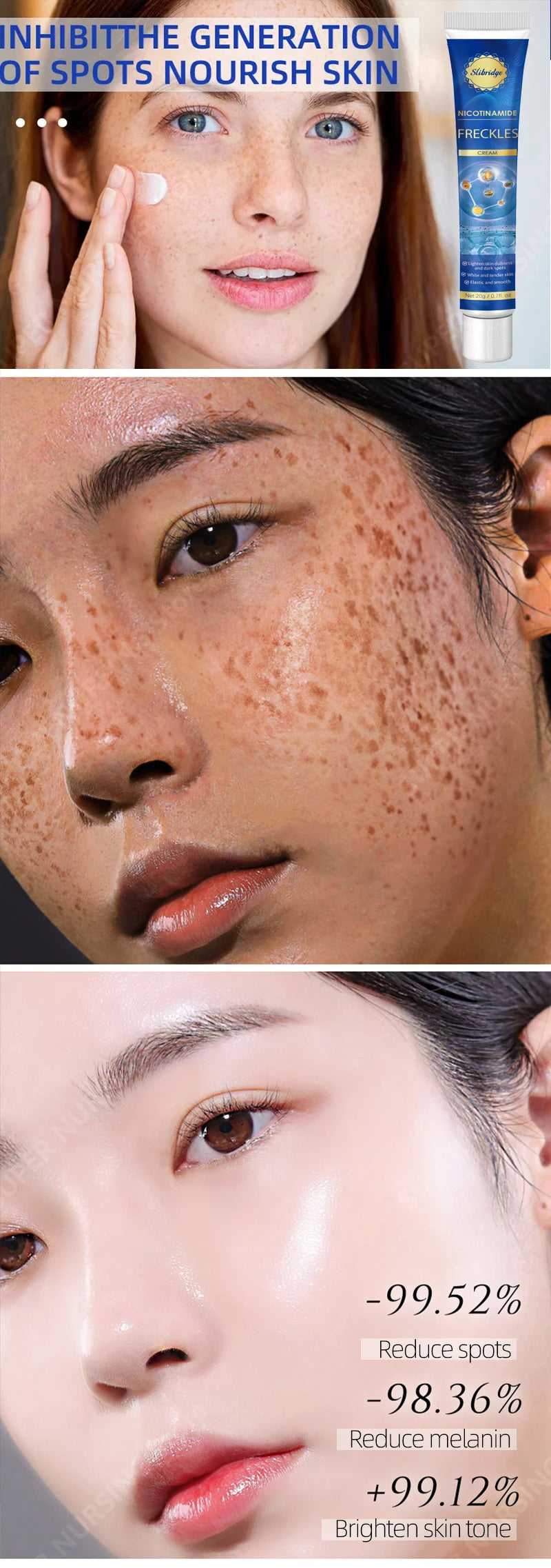 Freckles Cream Dark Spot