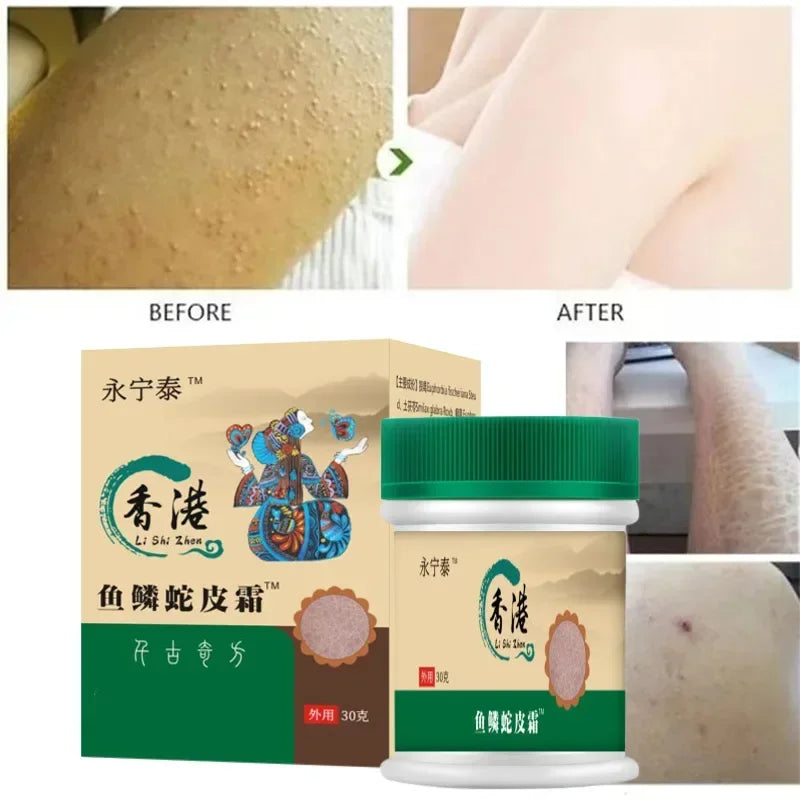 Chicken Skin Removal Treatment Body Scrub Cream Remove Dead Skin Cell Pore Spot Dull Whitening Moisturizing Body Care Cream