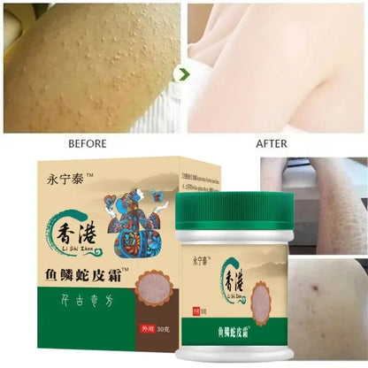 Chicken Skin Removal Treatment Body Scrub Cream Remove Dead Skin Cell Pore Spot Dull Whitening Moisturizing Body Care Cream