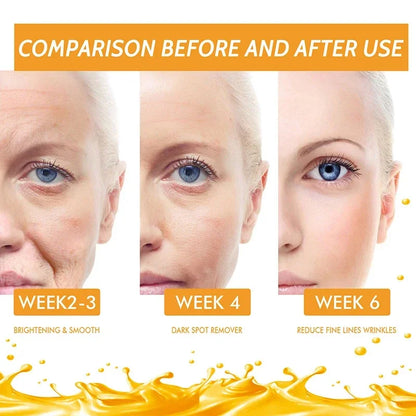 Vitamin C Remove Dark Spots face Serum Whiten Fade Freckles Anti-wrinkle Brighten Moisturize Collagen Korean Face Care Makeup