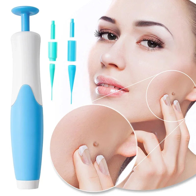 Skin Tag Remover Kit Mole Wart Remover Equipment Skin Tag Treatment Tool Facial Beauty Tool Home Use Easy To Clean