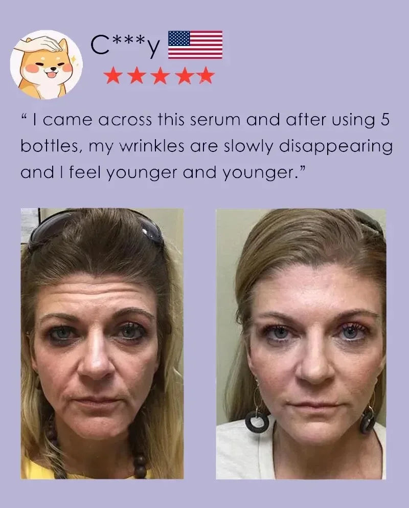 Instant Anti-wrinkle Serum Face Neck Forehead Wrinkles Removal Anti-aging Skin Lifting Firming Fine Lines Product