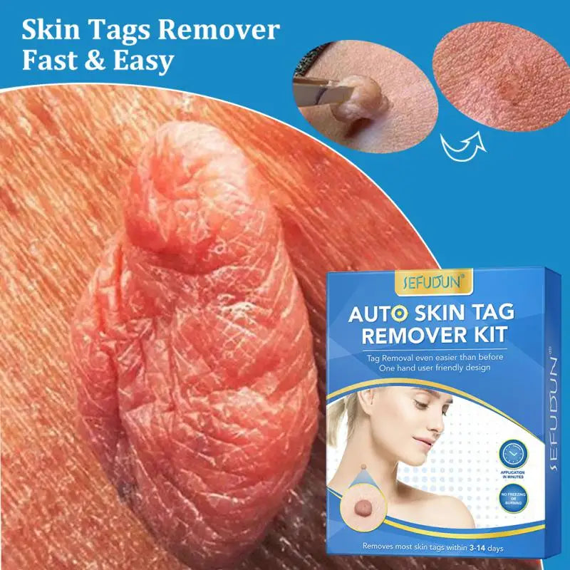 2 In1 Painless Auto Skin Tag Mole Removal Kit Cleaning Tools Face Skin Care Body Dot Treatments Remover Beauty Health