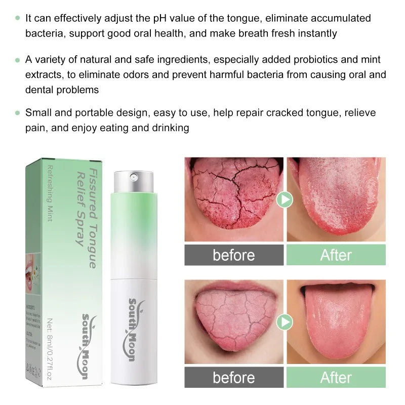 Fissured Tongue Relief Spray Breath Freshener Spray Regulates Health Mint Natural Flavor Care Oral Essence Mouth Health