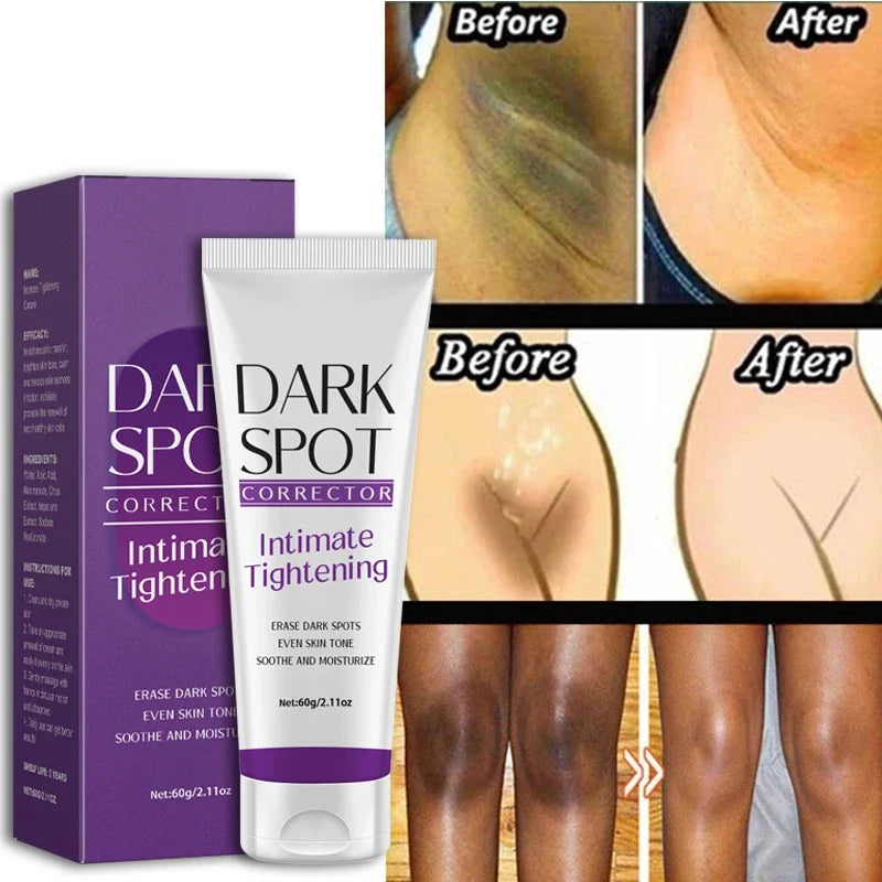 Whitening Cream Quickly Private Parts Dark Skin Underarm Brightening Cream Inner Thighs Elbows Bleach Joint Remove Melanin Cream