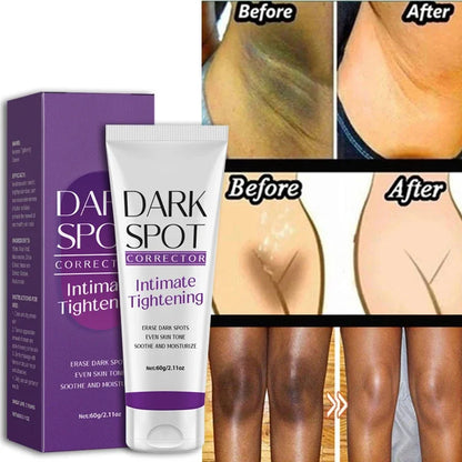 Whitening Cream Quickly Private Parts Dark Skin Underarm Brightening Cream Inner Thighs Elbows Bleach Joint Remove Melanin Cream