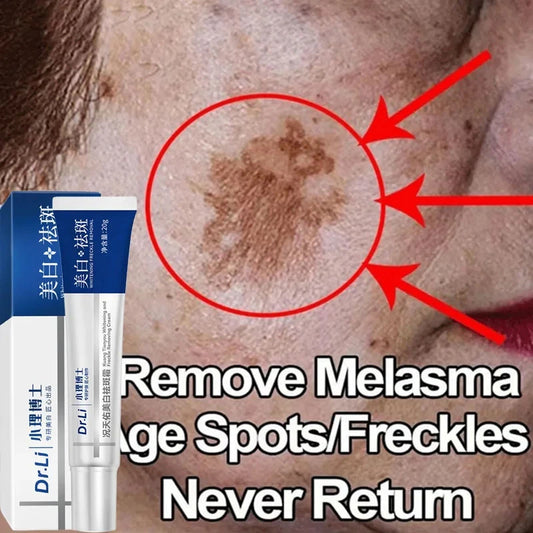 Effective Whitening Freckles Cream Remove Melasma Dark Spots Fade Pigmentation Moisturize Brighten Face Korean Skin Care Product