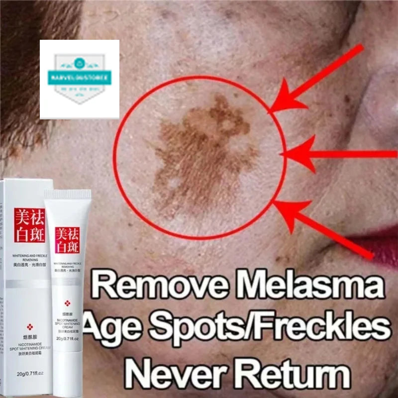 Effective Whiten Freckle Cream Brighten Face Remove Dark Face Spot Melasma Anti-pigmentation Improve Dullness Skin Care Cream