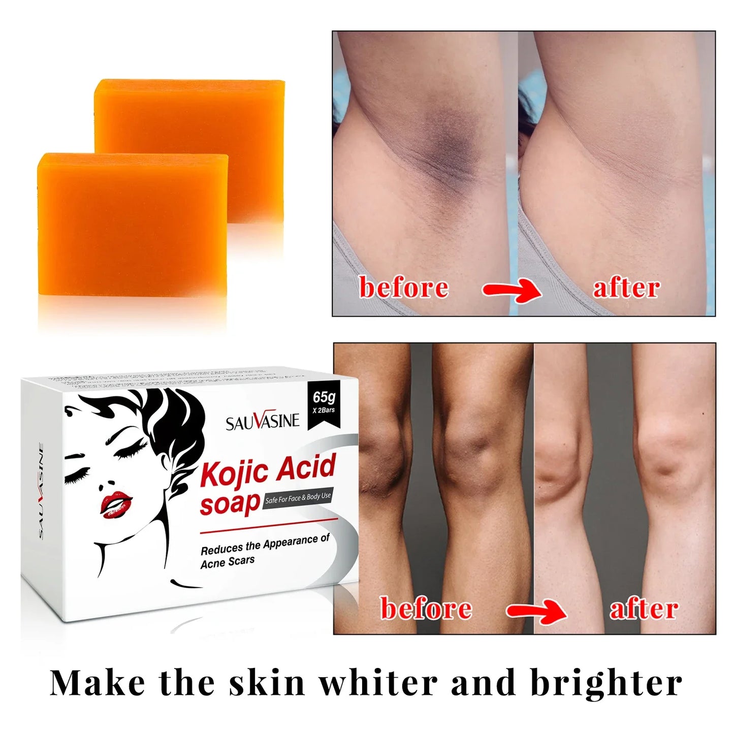 Kojic Acid Whitening Set Face Cream Moisturizer Facial Mask Collagen Face Repair Suncreen Facial Soap Anti-Aging Skin Care Kit