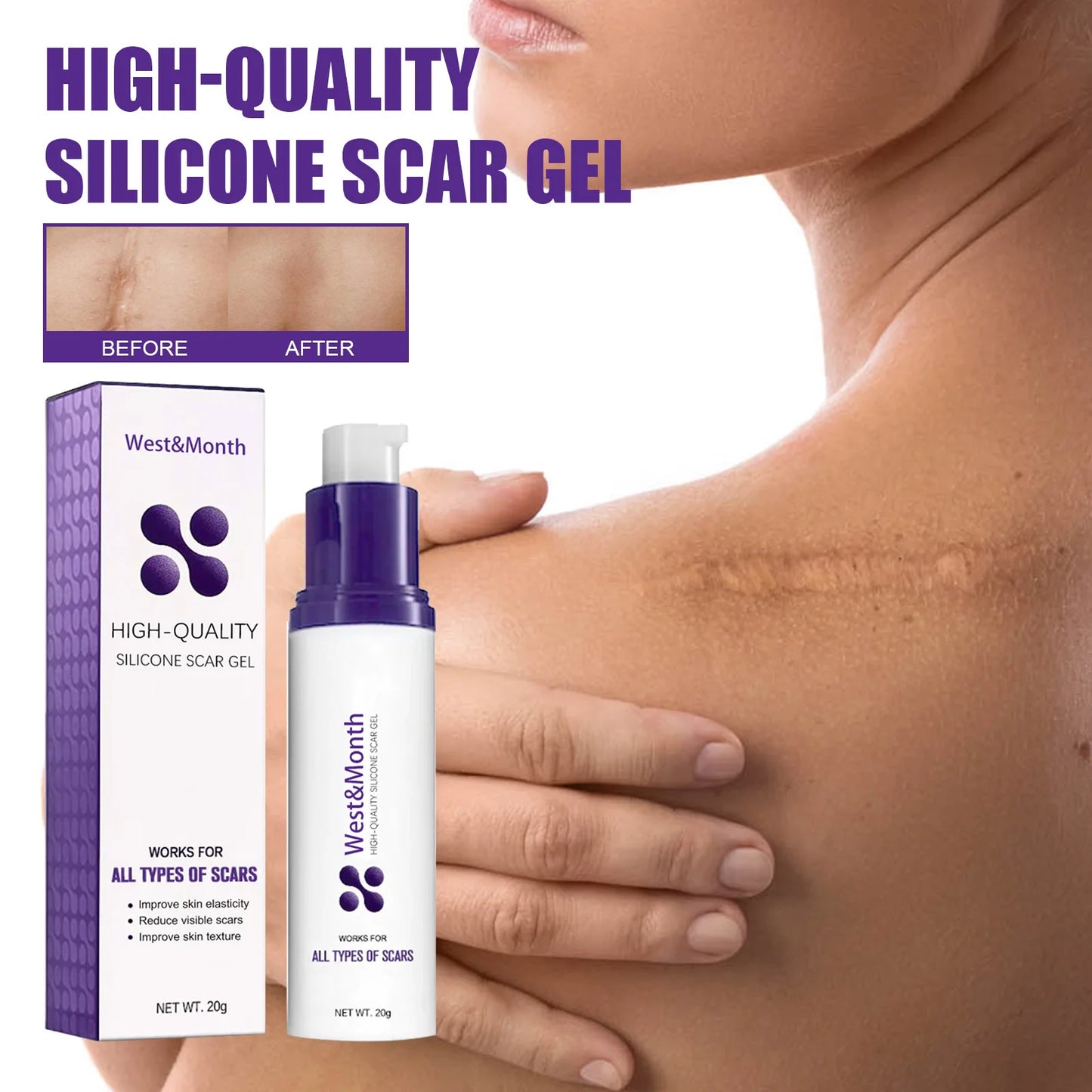 Recovery Scar Cream Fast Remove Deep Skin Scar Acne Stretch Marks Burn Keloid Spot Treat Gel Herbal Smooth Whiten Face Skin Care