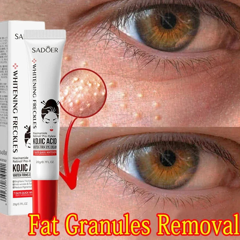 Fat Granules Remover Eye Cream Anti-Puffiness Anti Inflammatory Reduce Dark Circles Eyebags Fade Lines Moisturizing Eye Care