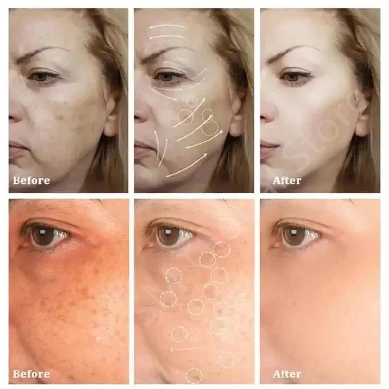 Whitening Freckle Cream Melasma Dark Spots Pigmentation Removal Products Fade Stain Melanin Repair Brighten Korean Skin Care