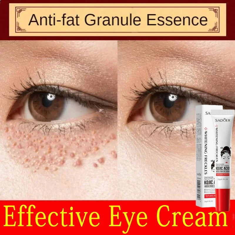 Fat Granules Remover Eye Cream Anti-Puffiness Anti Inflammatory Reduce Dark Circles Eyebags Fade Lines Moisturizing Eye Care