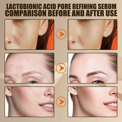 Vitamin C Remove Dark Spots face Serum Whiten Fade Freckles Anti-wrinkle Brighten Moisturize Collagen Korean Face Care Makeup