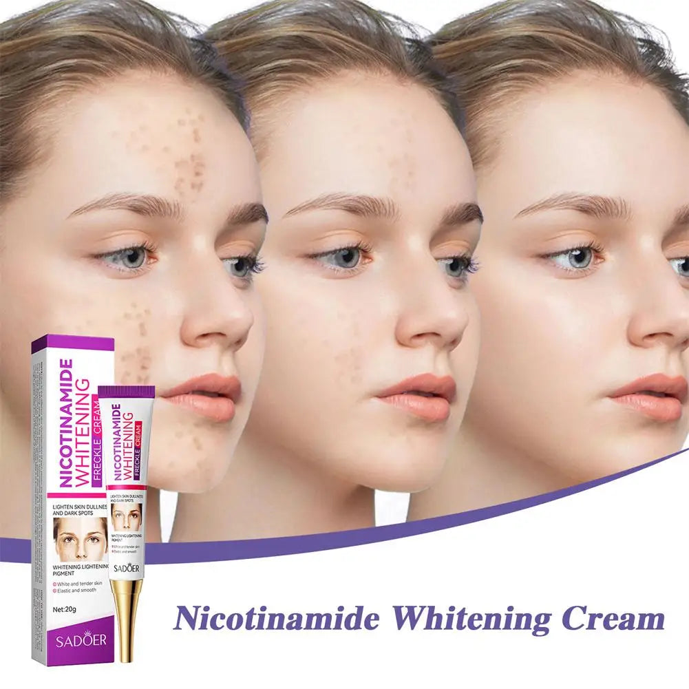 3pcs Nicotinamide Whitening Freckles Cream Remove Melasma Dark Spot Acne Marks Brightening Skin Tone Face Skin Care