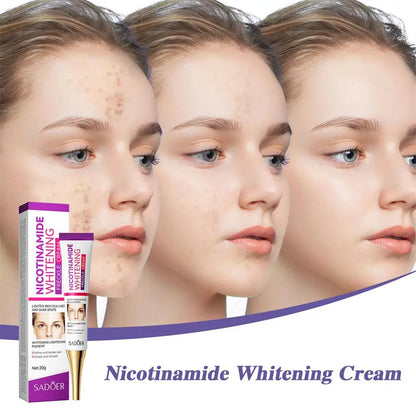 3pcs Nicotinamide Whitening Freckles Cream Remove Melasma Dark Spot Acne Marks Brightening Skin Tone Face Skin Care