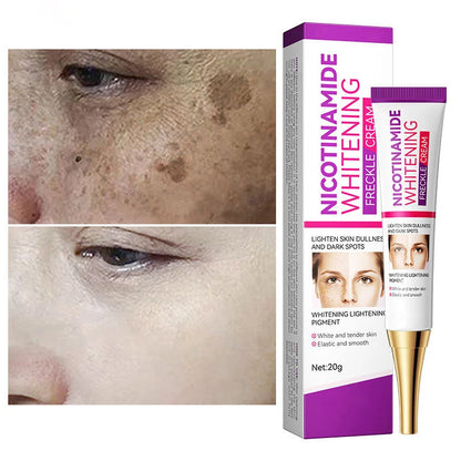 Face Melasma Remover Cream Whitening Removal Freckles Cream Nicotinamide Moisturizing Brightening Emulsion Fade Dark Spots Cream