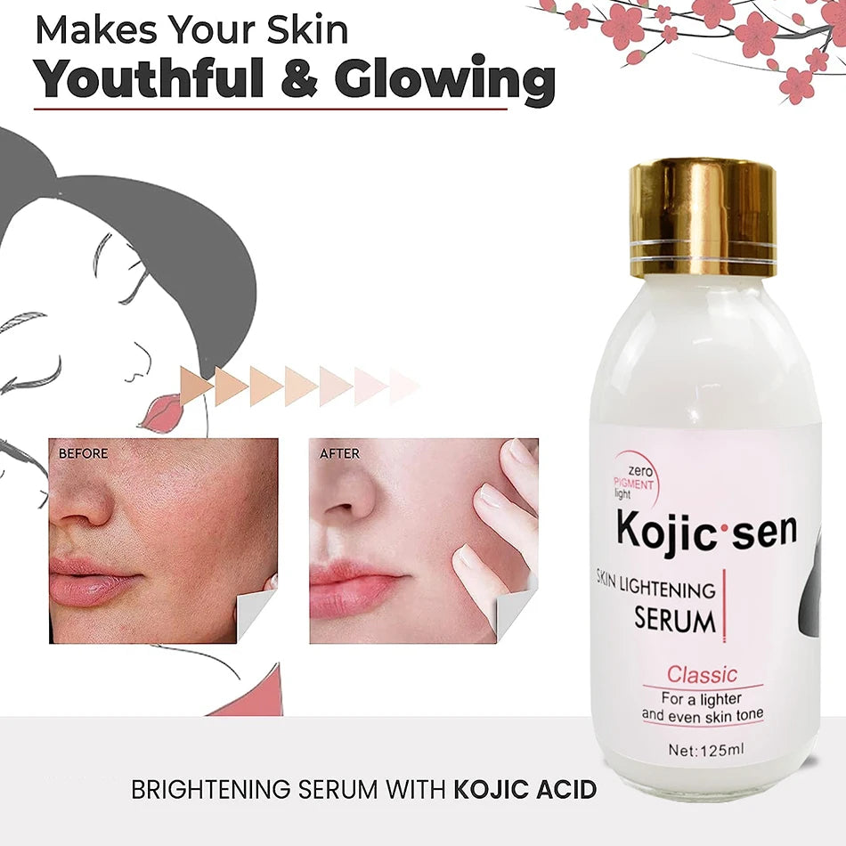 2pcs Kojic Concentre Kojic Acid Cream Strong Brightening Fade Stubborn Dark Spots Radiant Even Complexion Face Serum