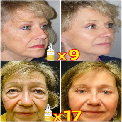 Anti-aging serum Neck wrinkle remover face lines skincare wrinkles for women anti age collagen boost Korean makeup products 2024