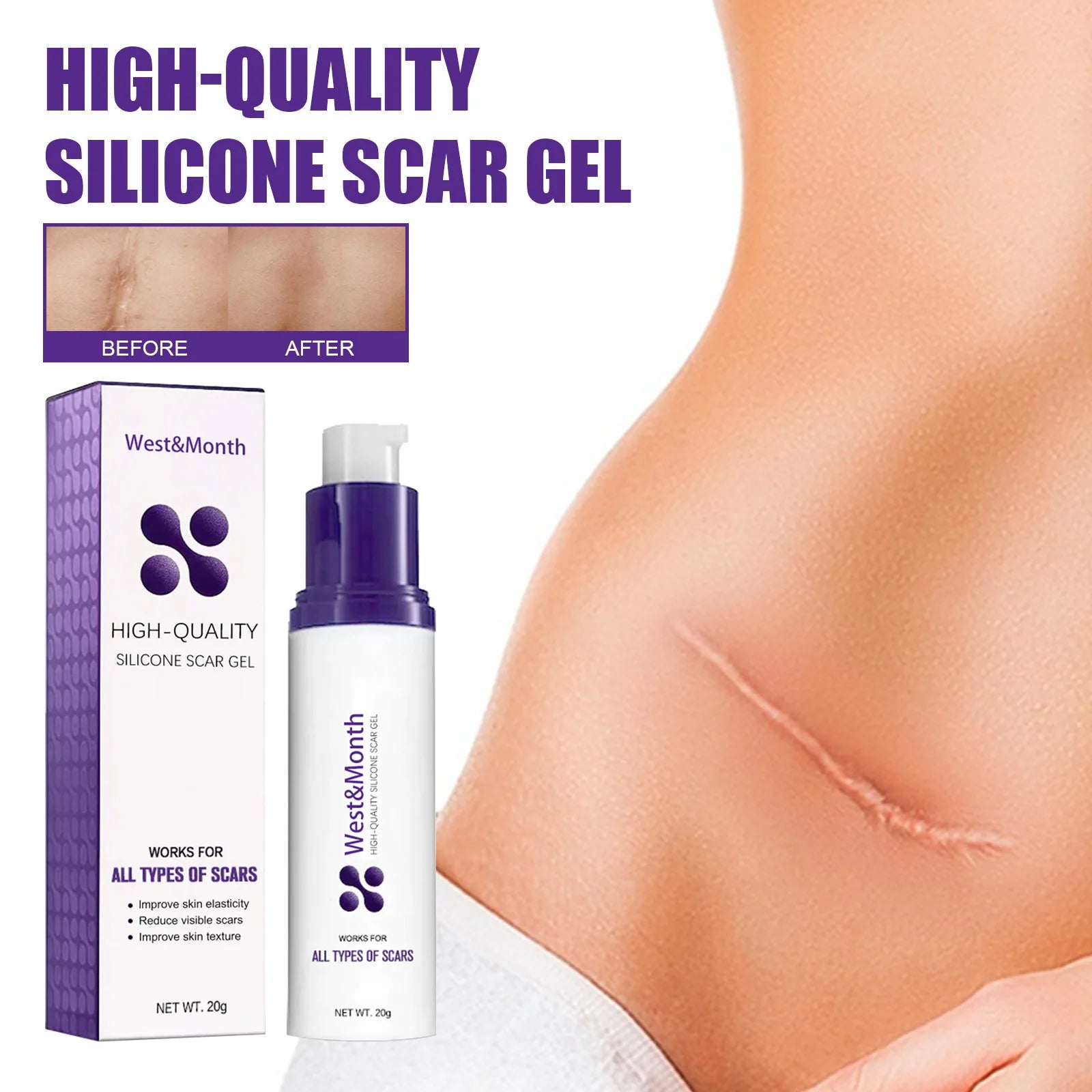 Recovery Scar Cream Fast Remove Deep Skin Scar Acne Stretch Marks Burn Keloid Spot Treat Gel Herbal Smooth Whiten Face Skin Care