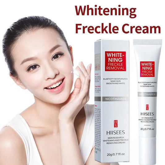 Face Freckles Cream Whitening Skin Remove Melasma Dark Spots Lighten Remover Moisturizing Brightening Cream 20g Skin Care