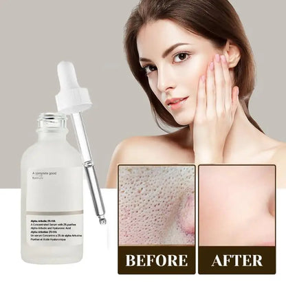 30ml Arbutin Stock Solution Rejuvenating Essence Brightens Skin Decomposes Pigments Whiten Improves Bleaching Dark Spot Serum