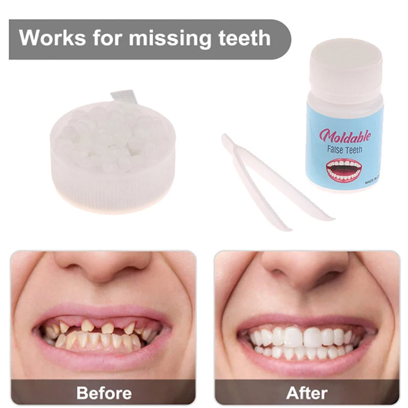 10g-30g Temporary Tooth Repair Kit Teeth And Gaps FalseTeeth Solid Glue Denture Adhesive Teeth Whitening Tooth Beauty Tool