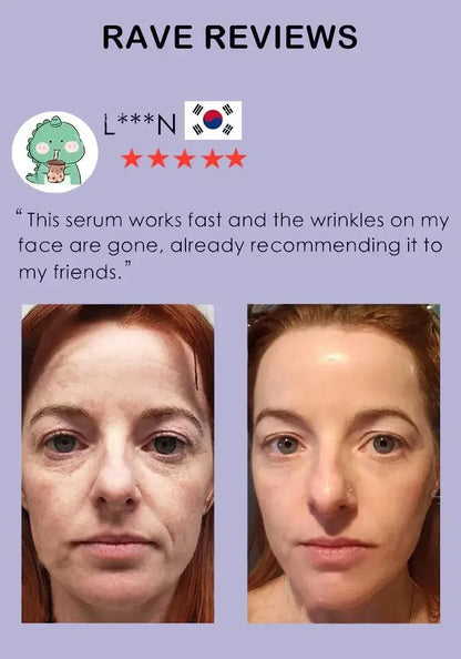 Instant Anti-wrinkle Serum Face Neck Forehead Wrinkles Removal Anti-aging Skin Lifting Firming Fine Lines Product