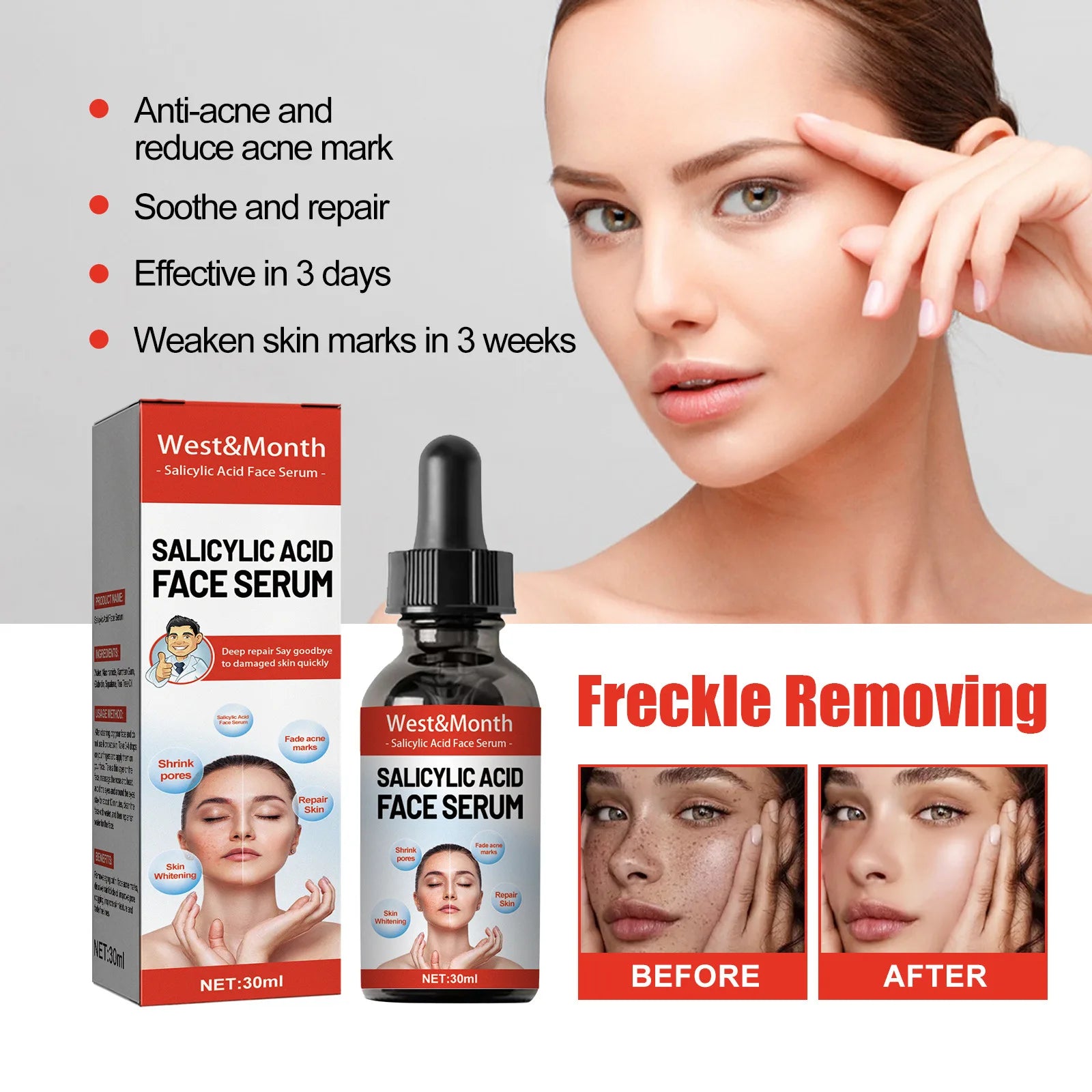 30ml Salicylic Acid Facial Serum Effectively Remove Melasma Lighten Dark Spots Acne Marks And Brighten Skin Tone