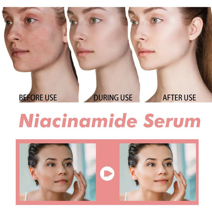 Peach Niacinamide Essence Fade Fine Lines Facial Serum Women Moisturize Brighten Face Serum Fade Dull Melasma Lighten Skin Care