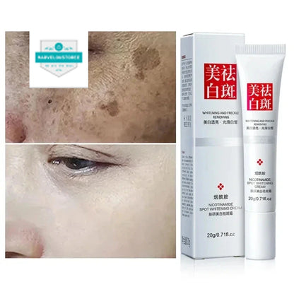 Effective Whiten Freckle Cream Brighten Face Remove Dark Face Spot Melasma Anti-pigmentation Improve Dullness Skin Care Cream